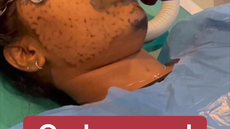 video (2)